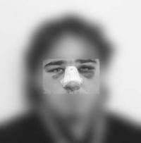 Víctima d'agressió feixista